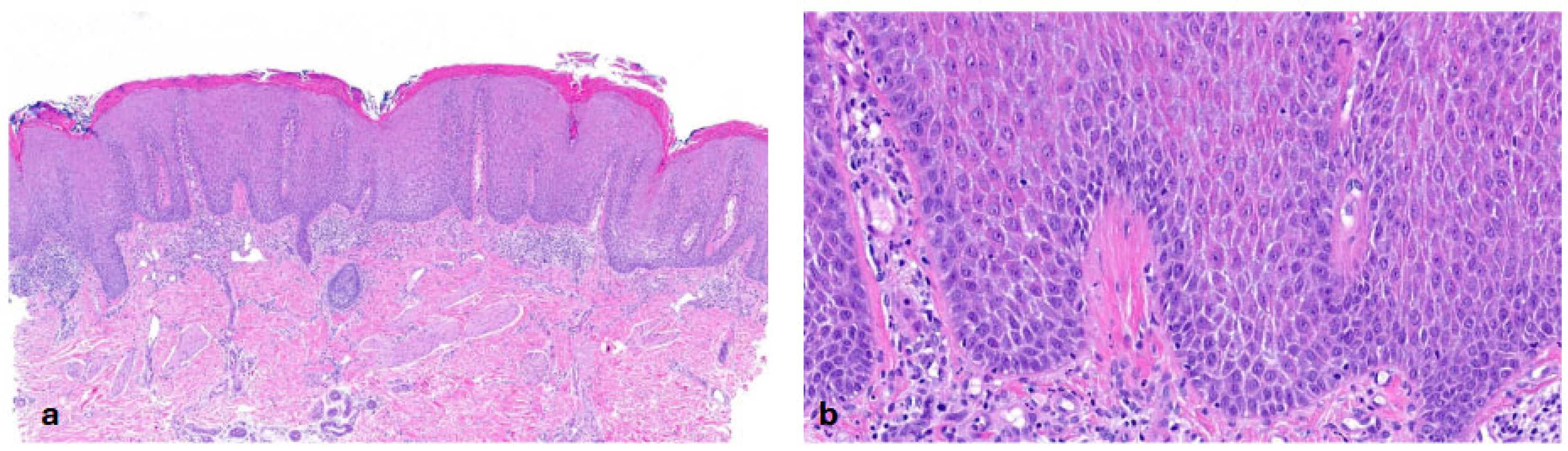 Dermatopathology 13 00009 g011 Dermatopathology 13 00009 g011