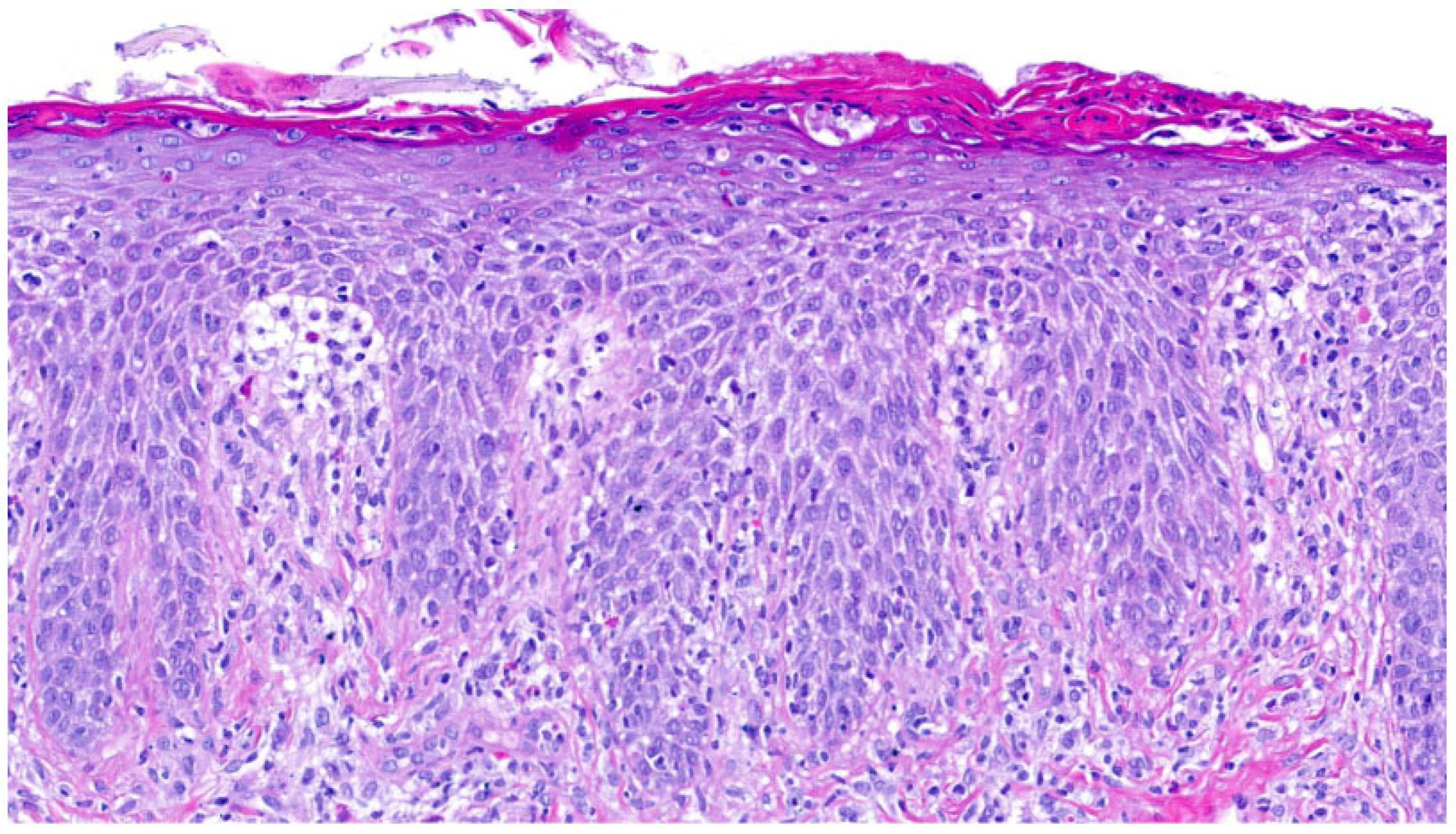 Dermatopathology 13 00009 g012 Dermatopathology 13 00009 g012