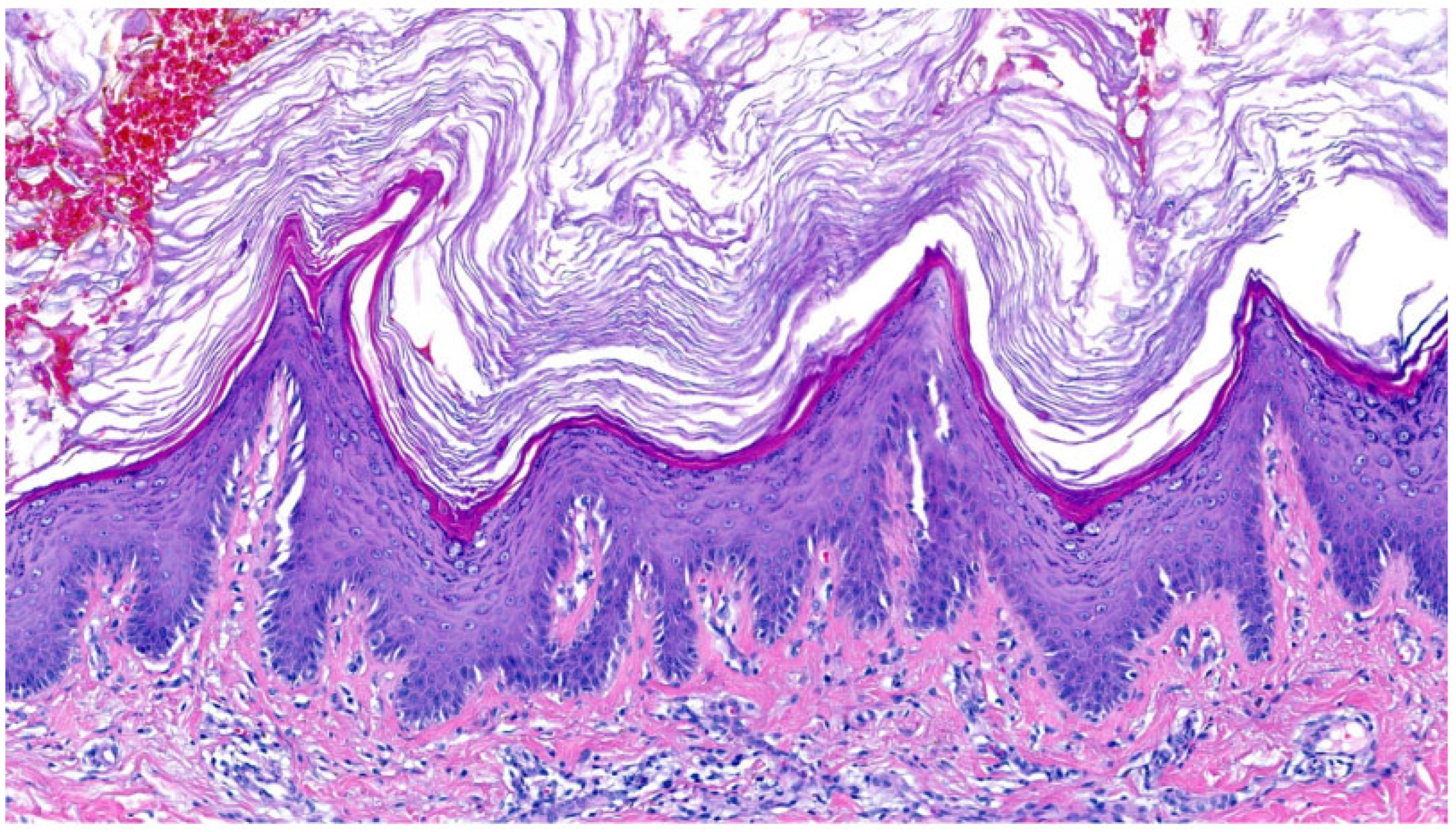 Dermatopathology 13 00009 g013 Dermatopathology 13 00009 g013