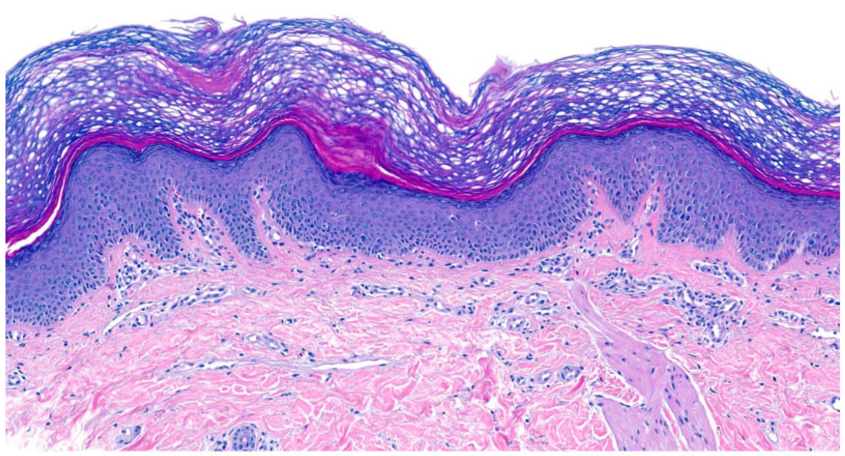 Dermatopathology 13 00009 g014 Dermatopathology 13 00009 g014