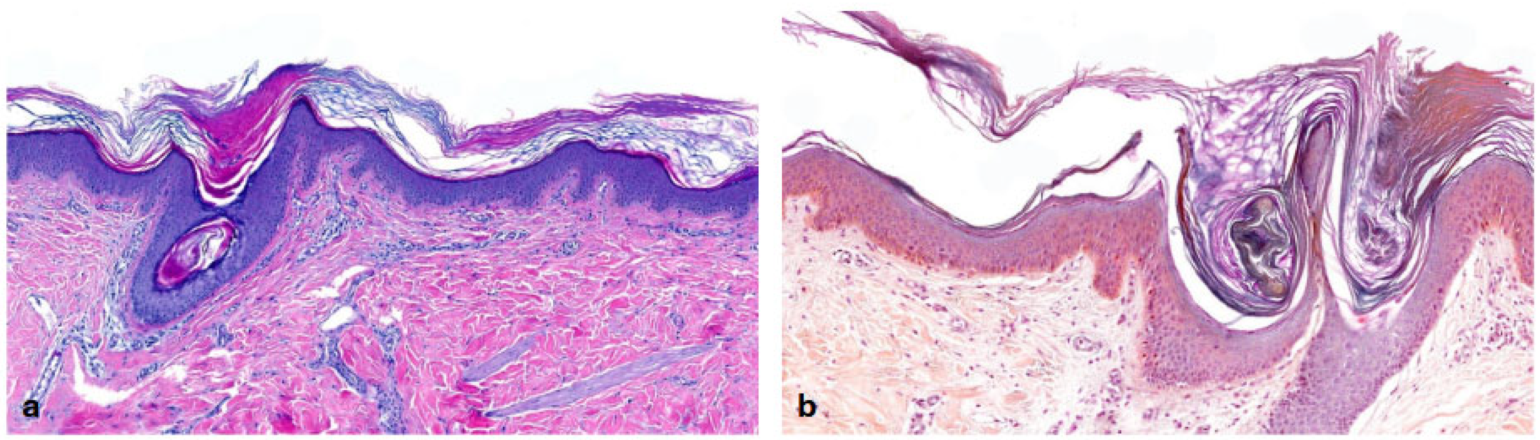 Dermatopathology 13 00009 g015 Dermatopathology 13 00009 g015