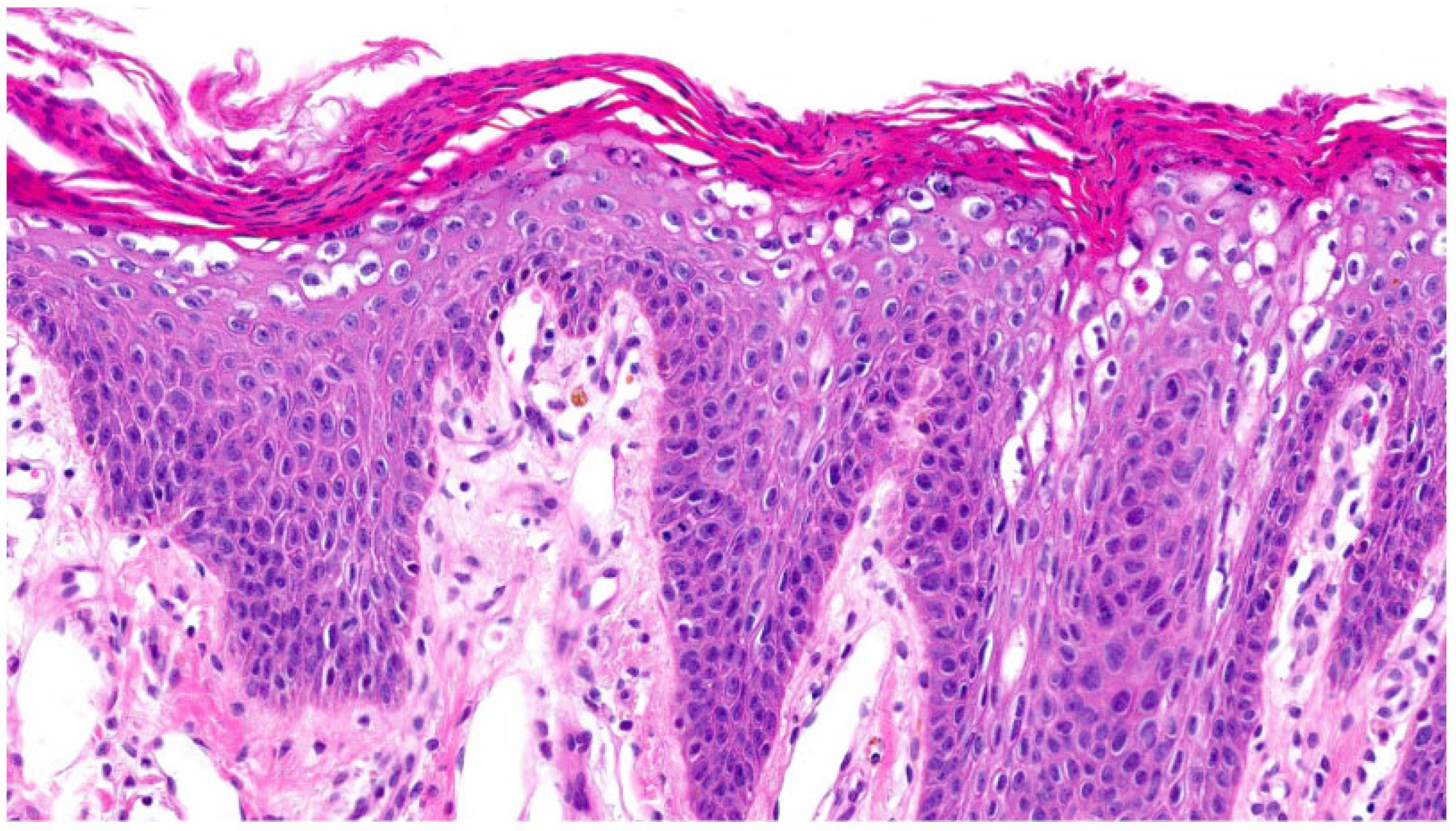 Dermatopathology 13 00009 g016 Dermatopathology 13 00009 g016
