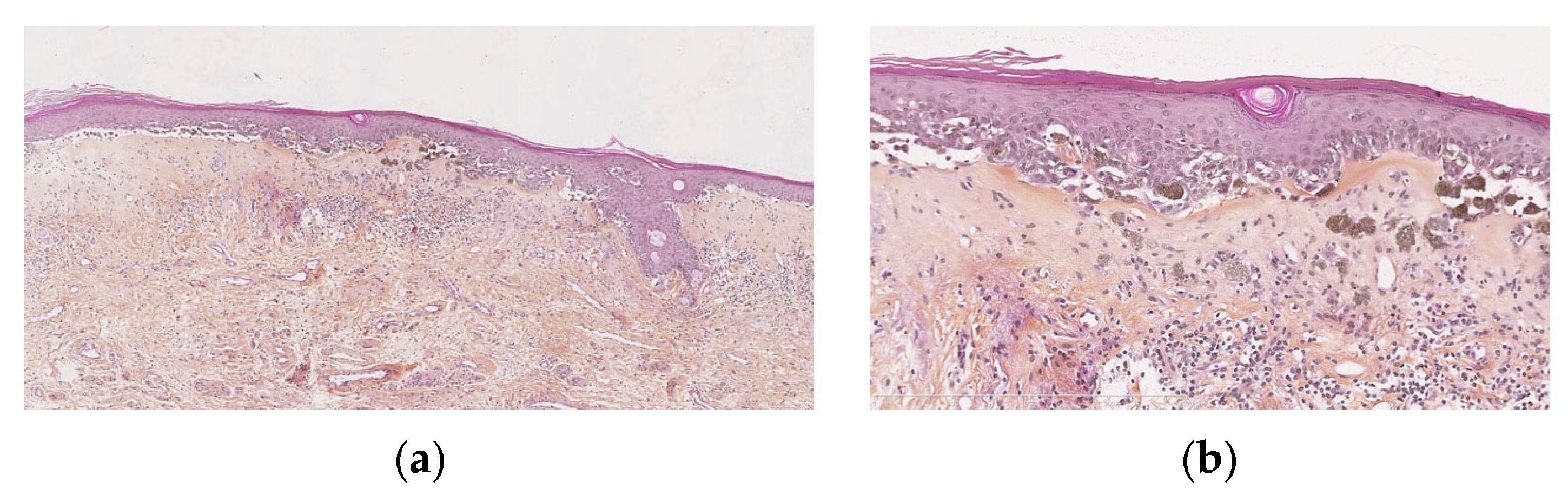 Dermatopathology 13 00012 g003