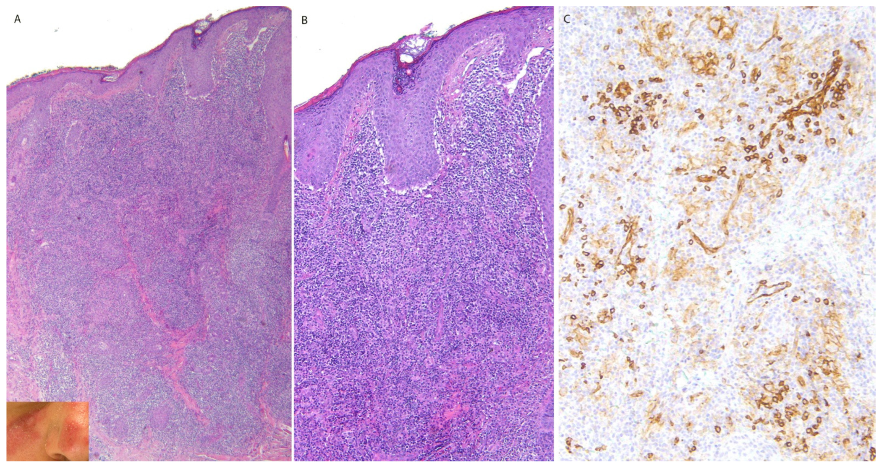 Dermatopathology 13 00023 g001 Dermatopathology 13 00023 g001