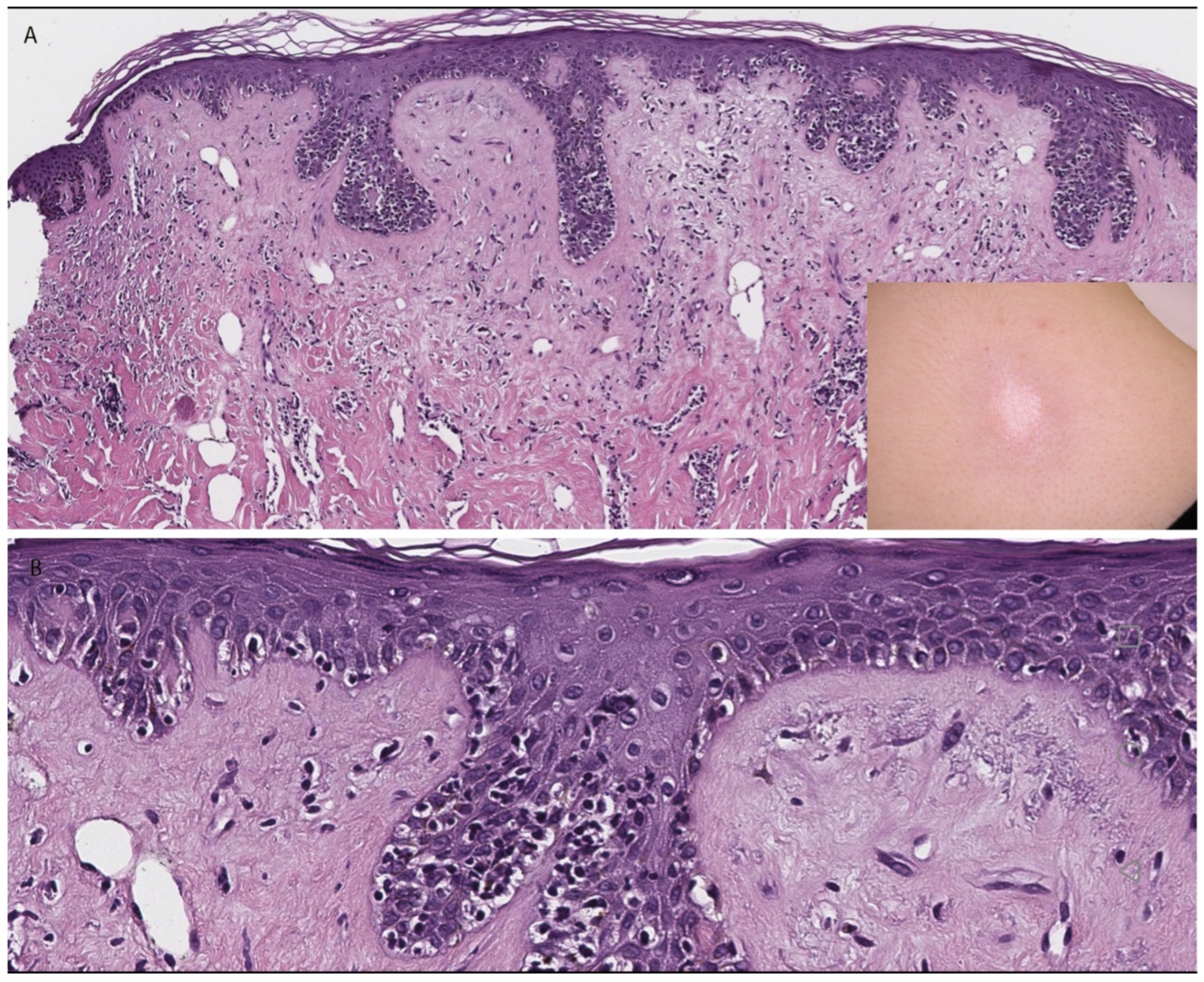 Dermatopathology 13 00023 g002 Dermatopathology 13 00023 g002
