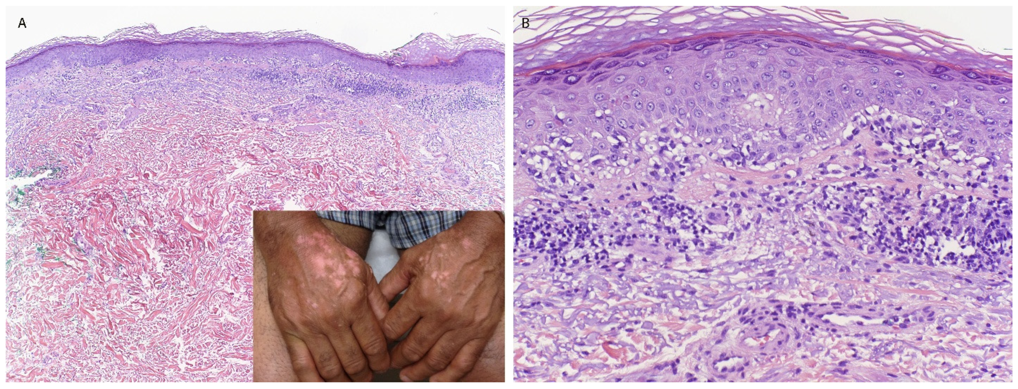 Dermatopathology 13 00023 g003 Dermatopathology 13 00023 g003