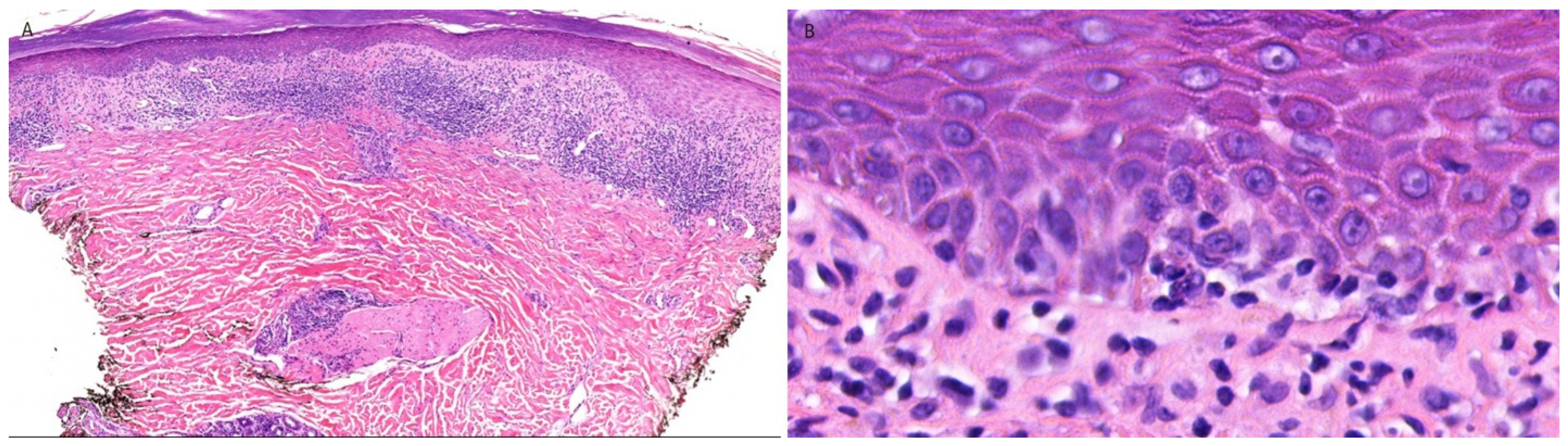 Dermatopathology 13 00023 g005 Dermatopathology 13 00023 g005
