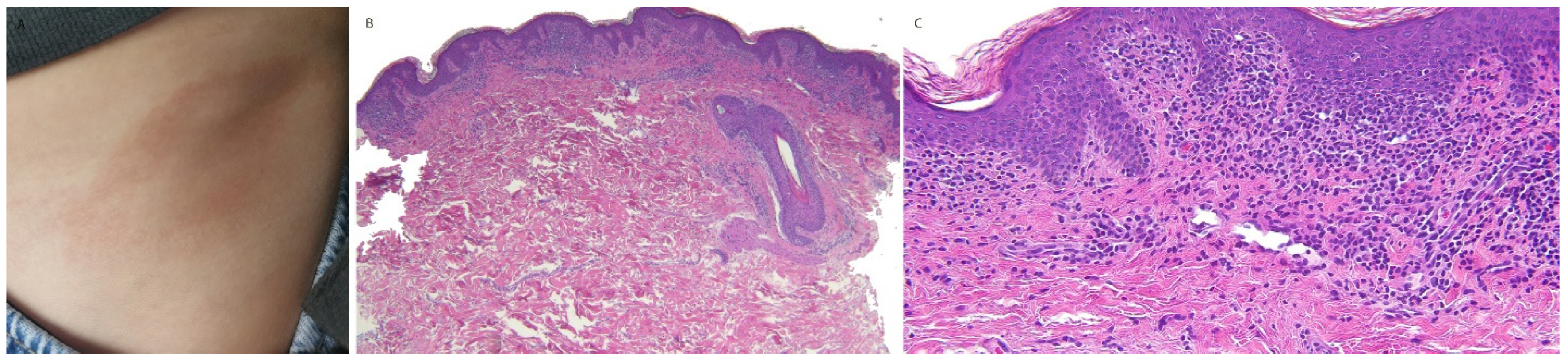 Dermatopathology 13 00023 g007 Dermatopathology 13 00023 g007