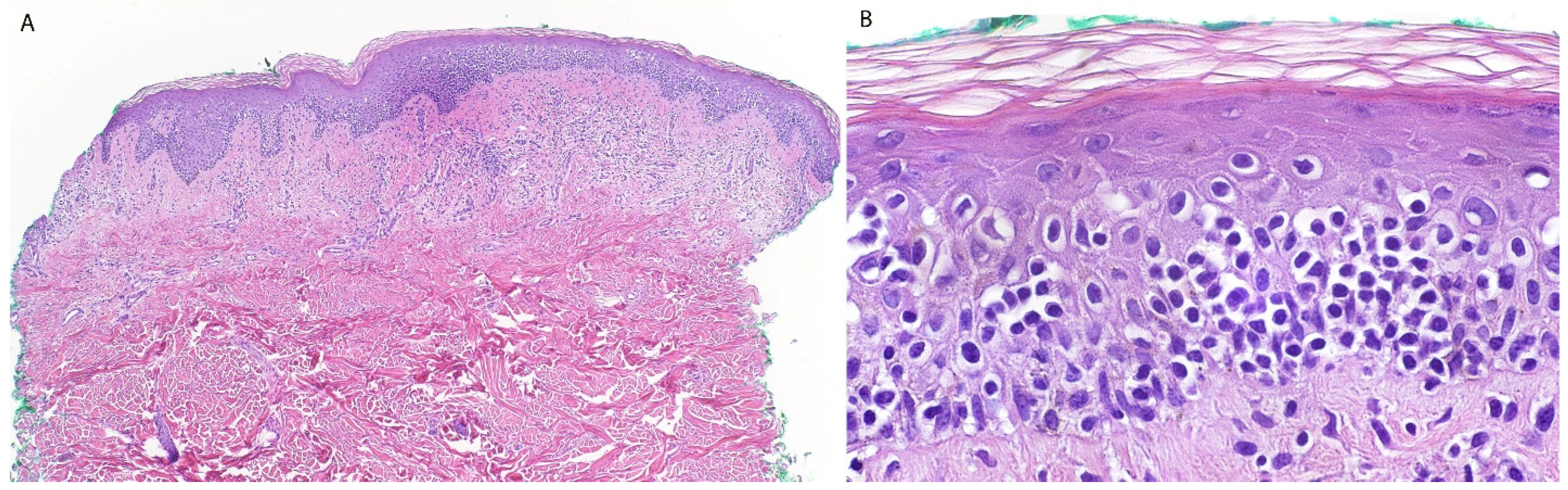 Dermatopathology 13 00023 g008 Dermatopathology 13 00023 g008