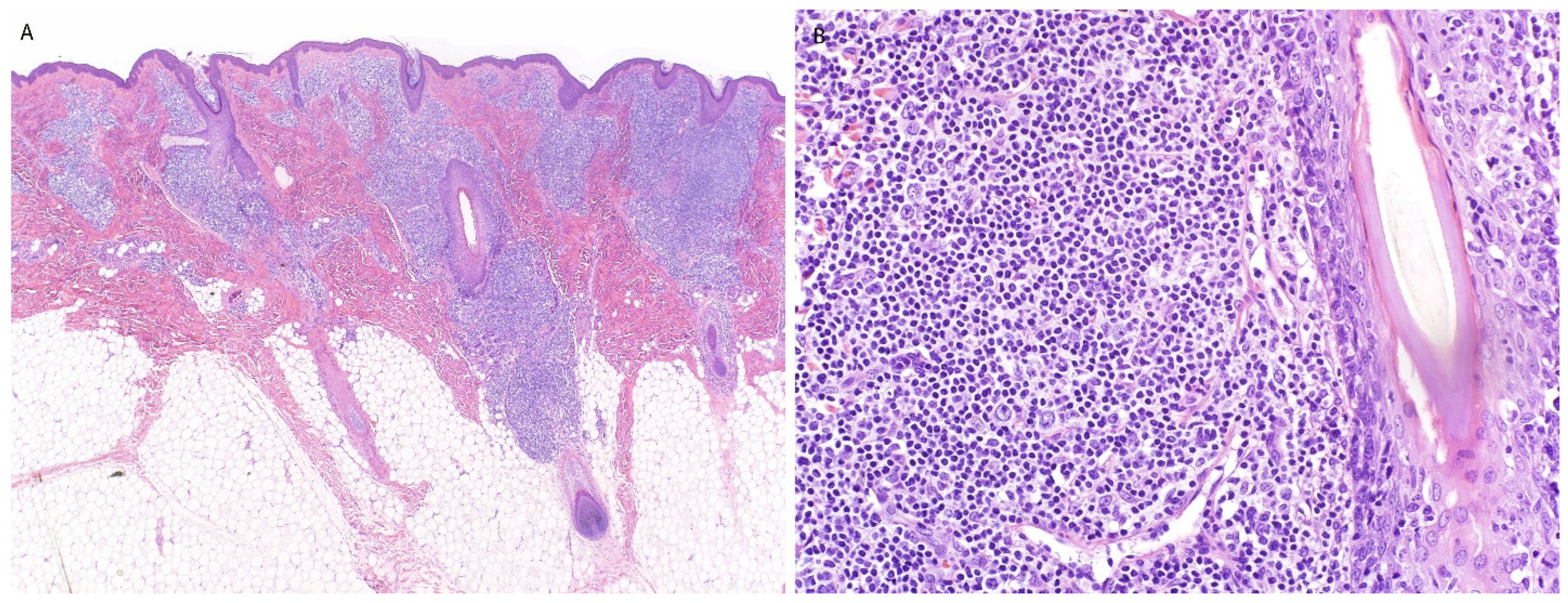 Dermatopathology 13 00023 g009 Dermatopathology 13 00023 g009