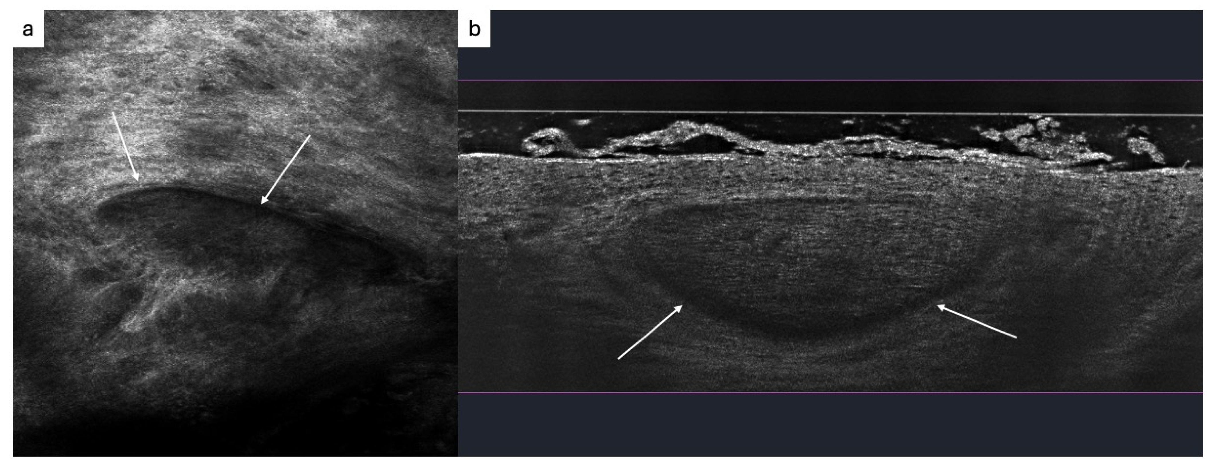 Dermatopathology 13 00038 g001 Dermatopathology 13 00038 g001