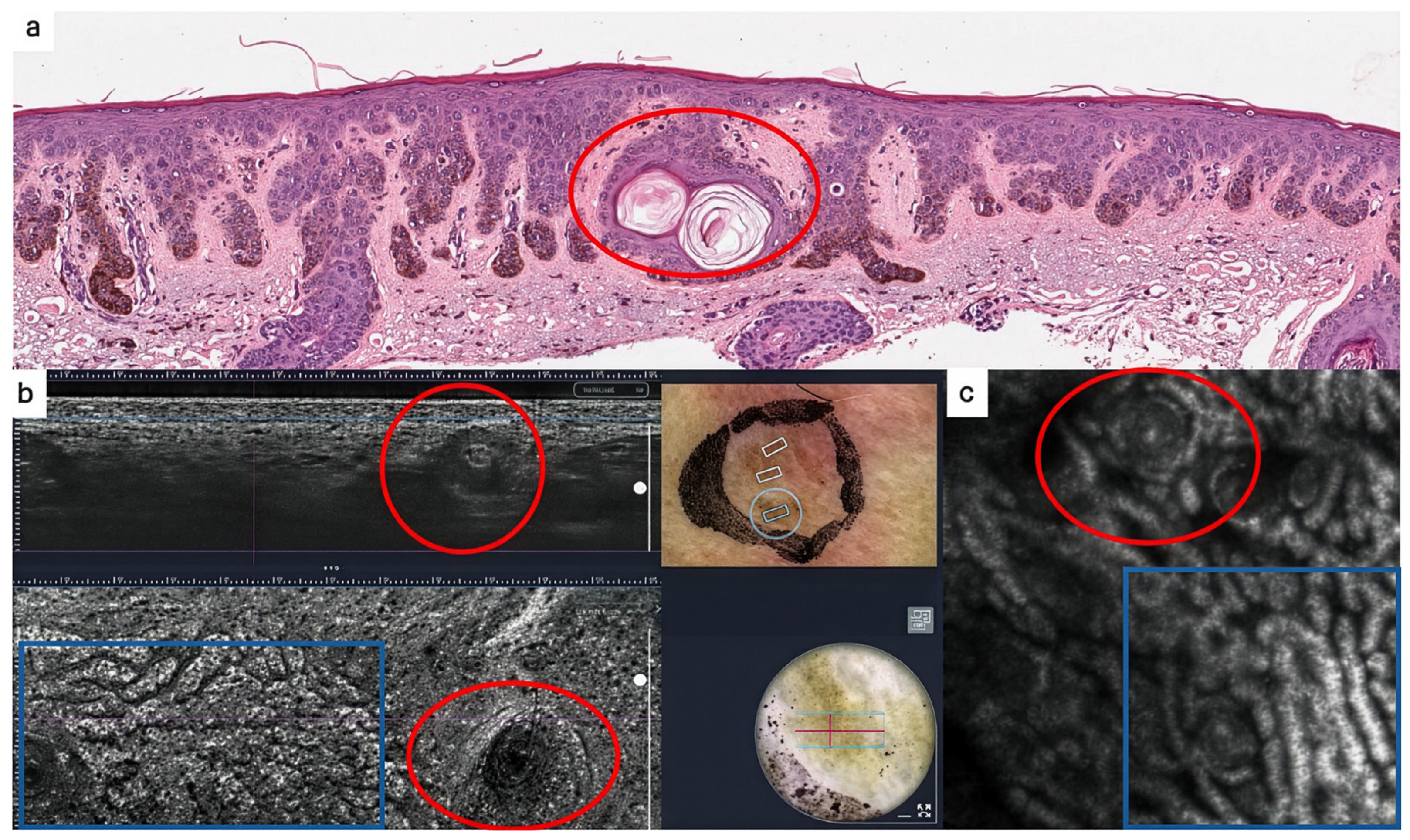 Dermatopathology 13 00038 g002 Dermatopathology 13 00038 g002