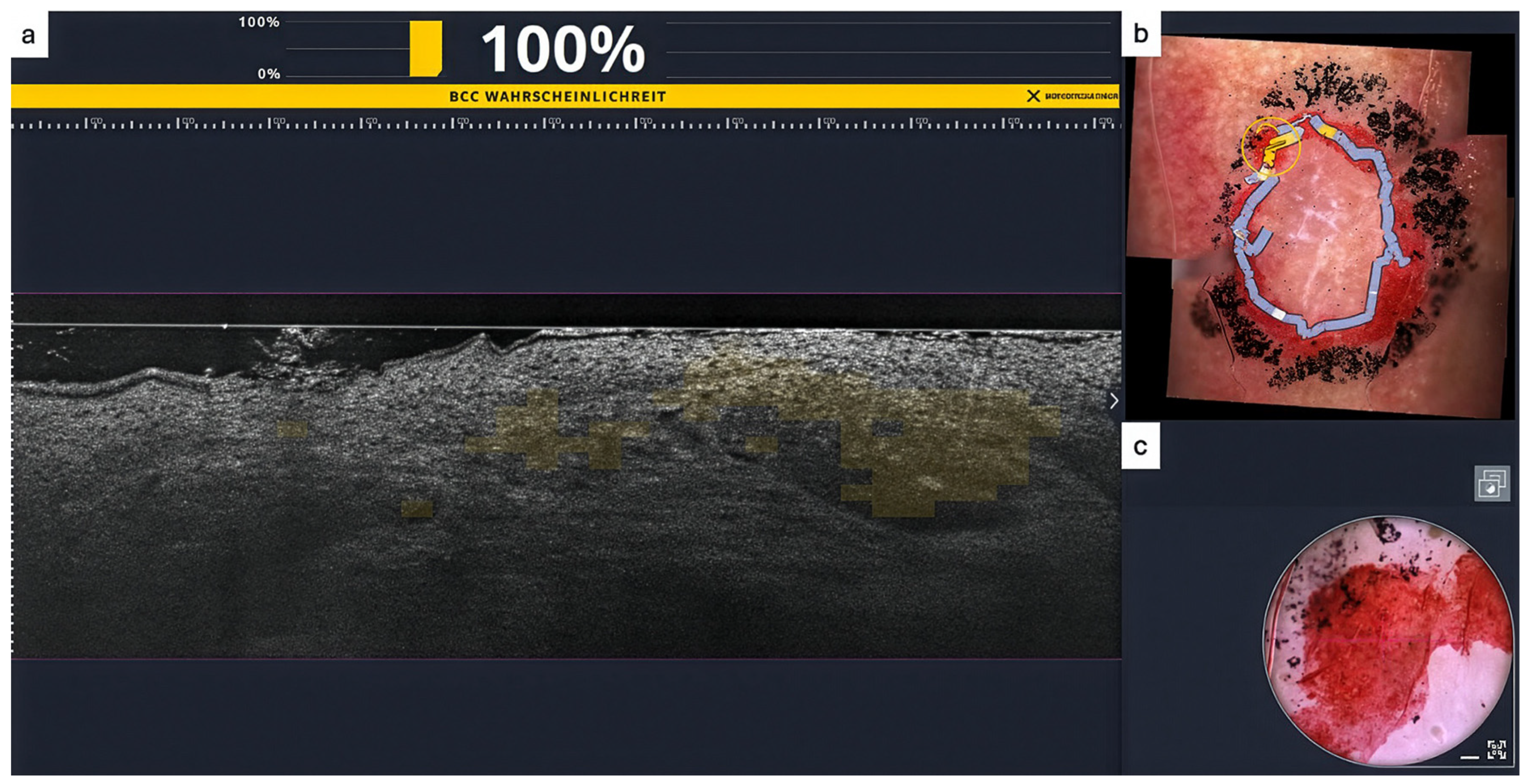 Dermatopathology 13 00038 g003 Dermatopathology 13 00038 g003