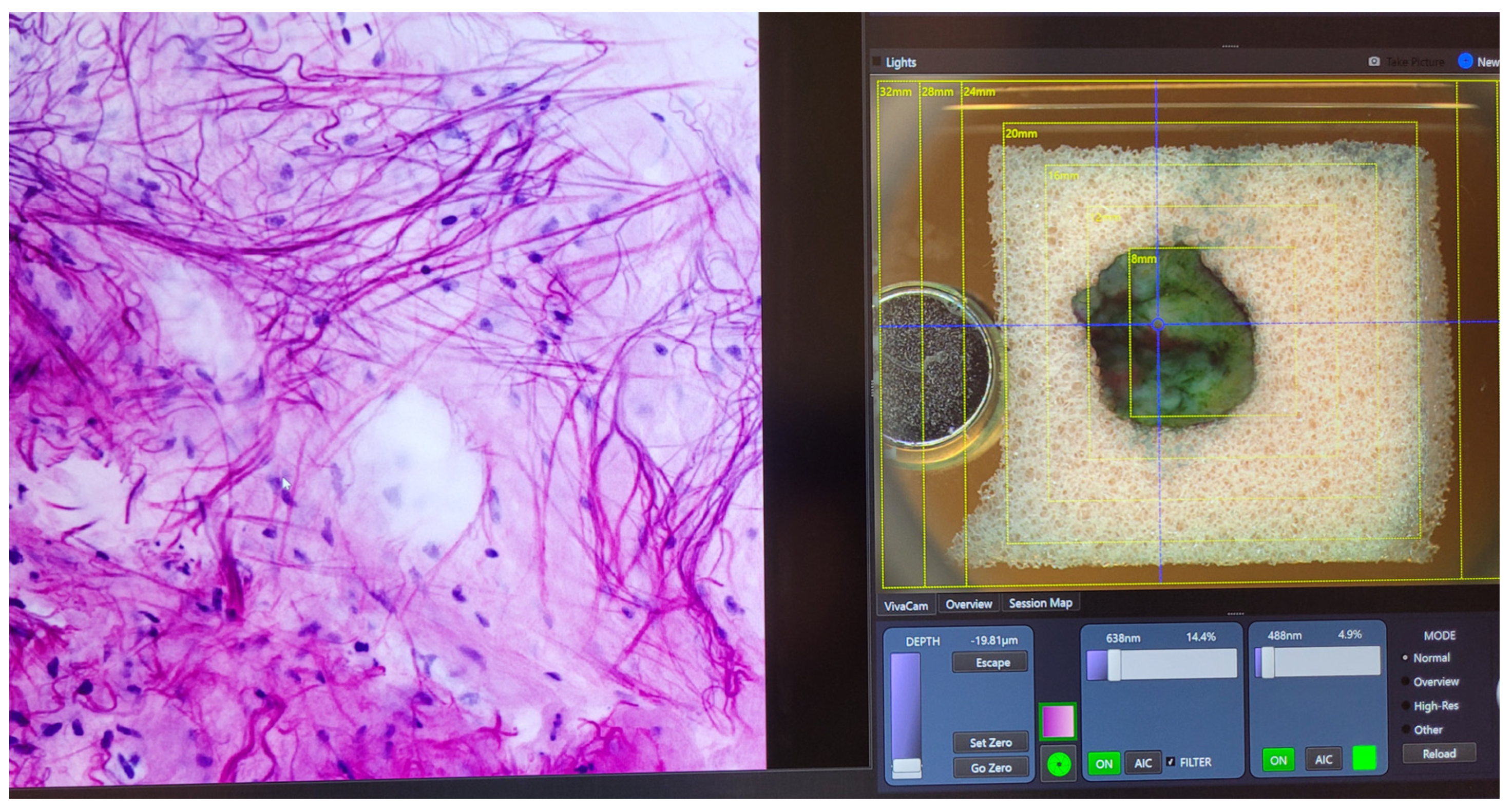Dermatopathology 13 00038 g005 Dermatopathology 13 00038 g005