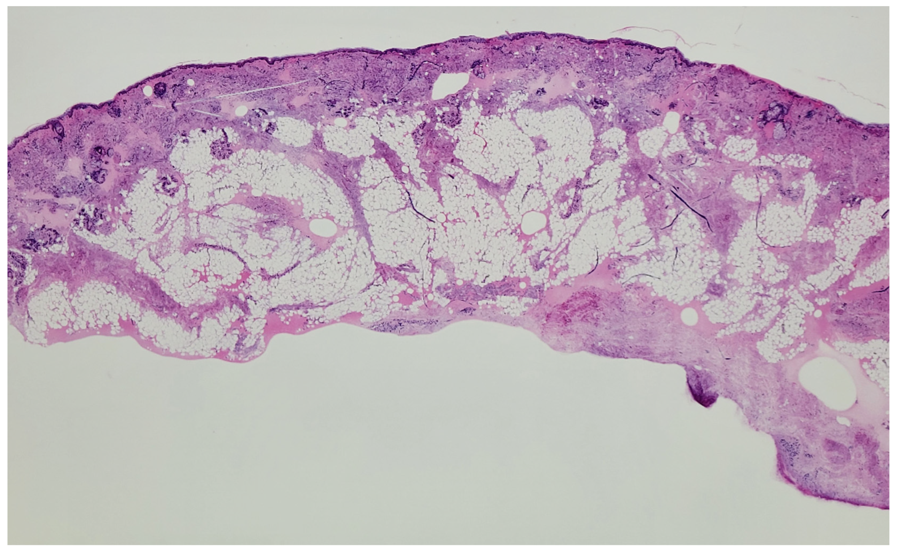 Dermatopathology 13 00038 g006 Dermatopathology 13 00038 g006
