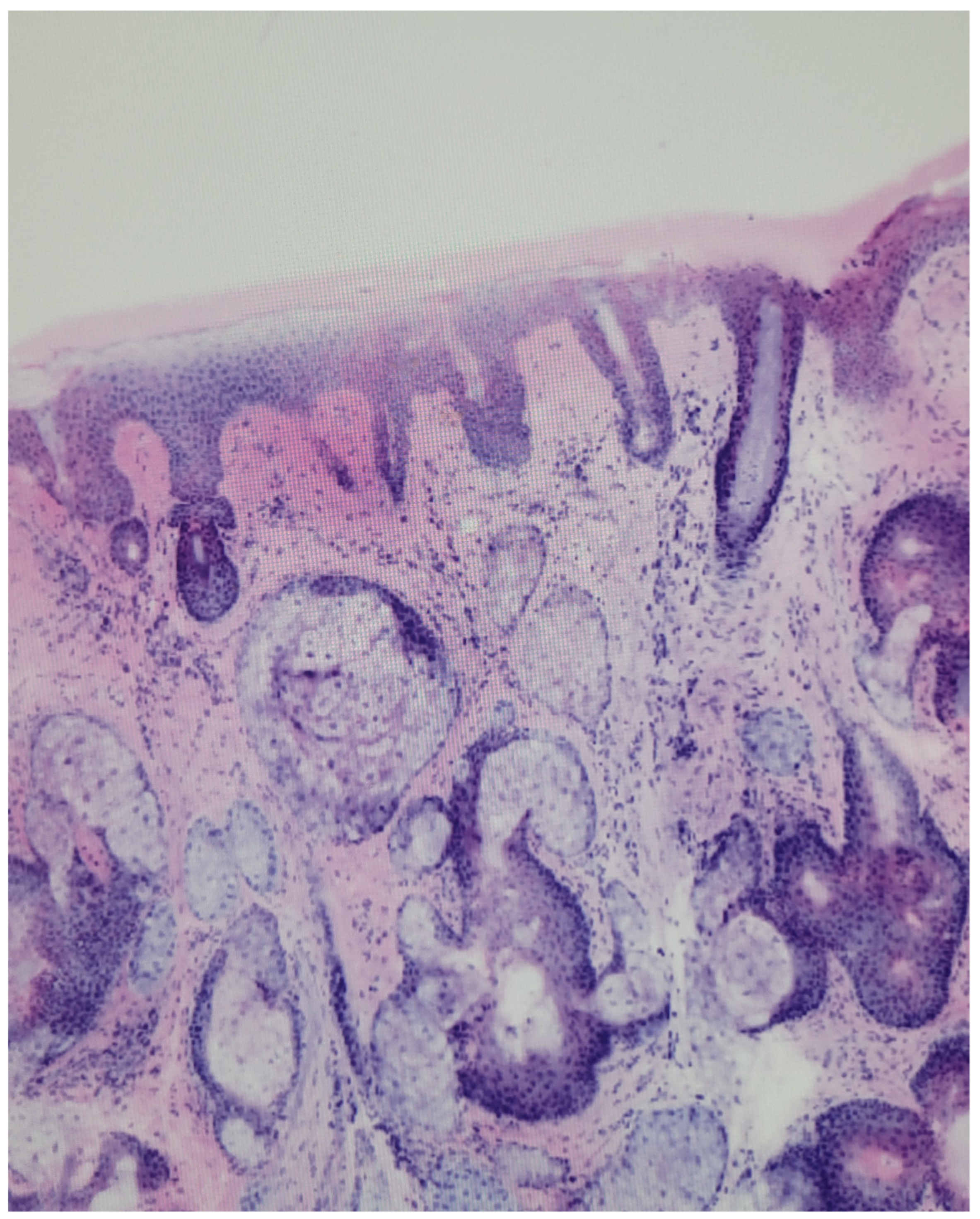 Dermatopathology 13 00038 g007 Dermatopathology 13 00038 g007