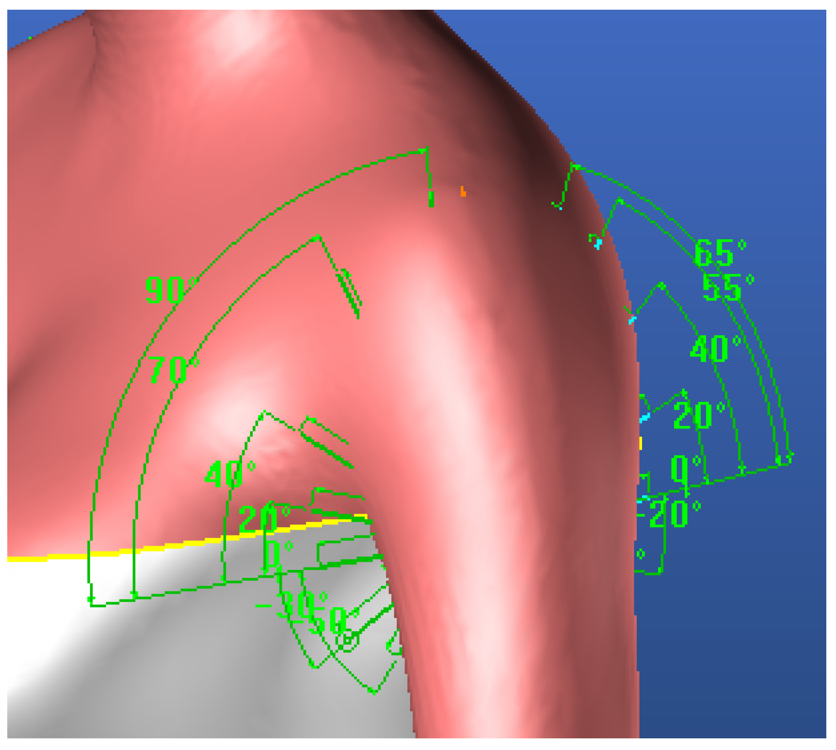 Designs 03 00053 g010