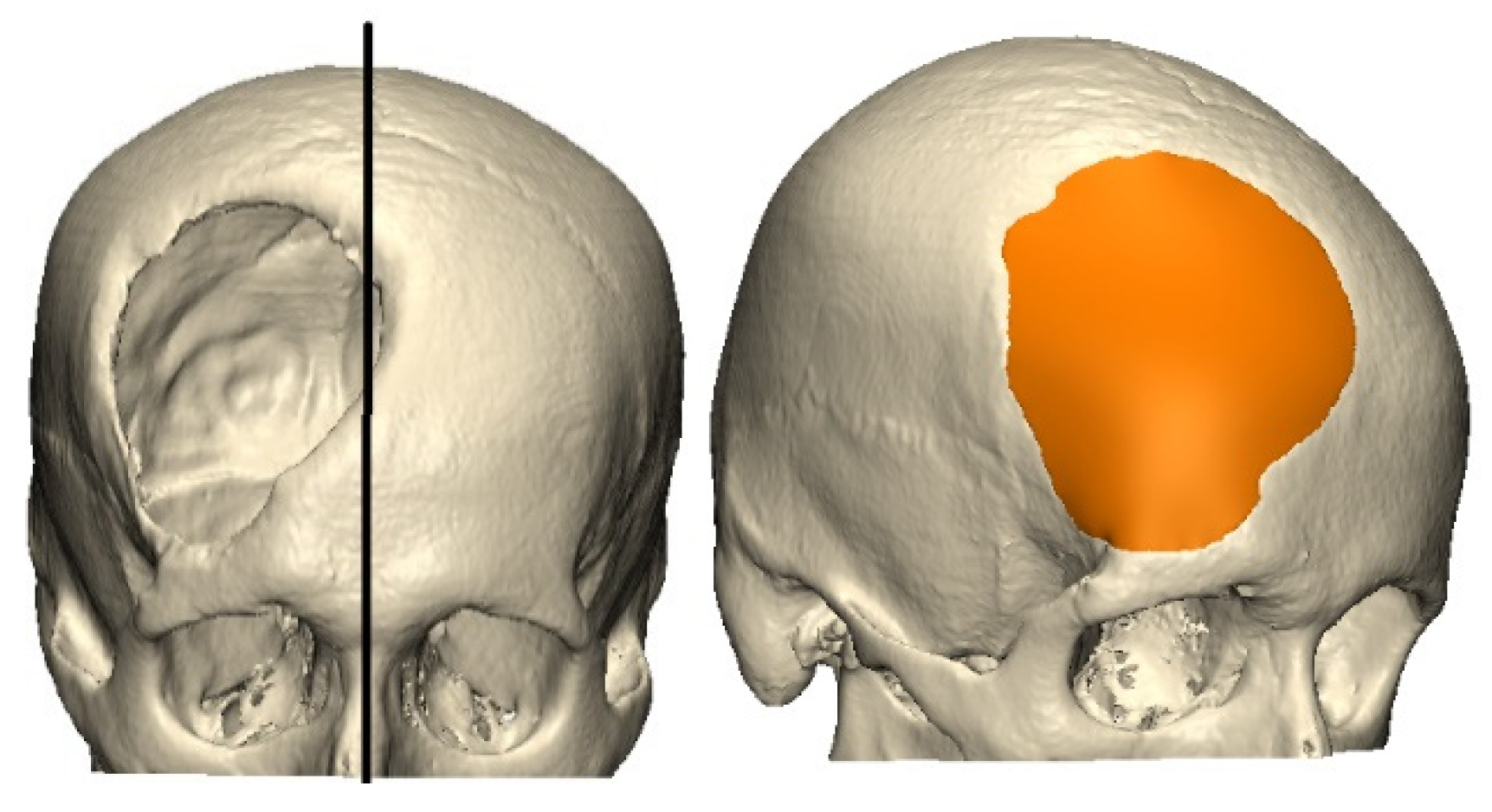 Designs 08 00031 g001