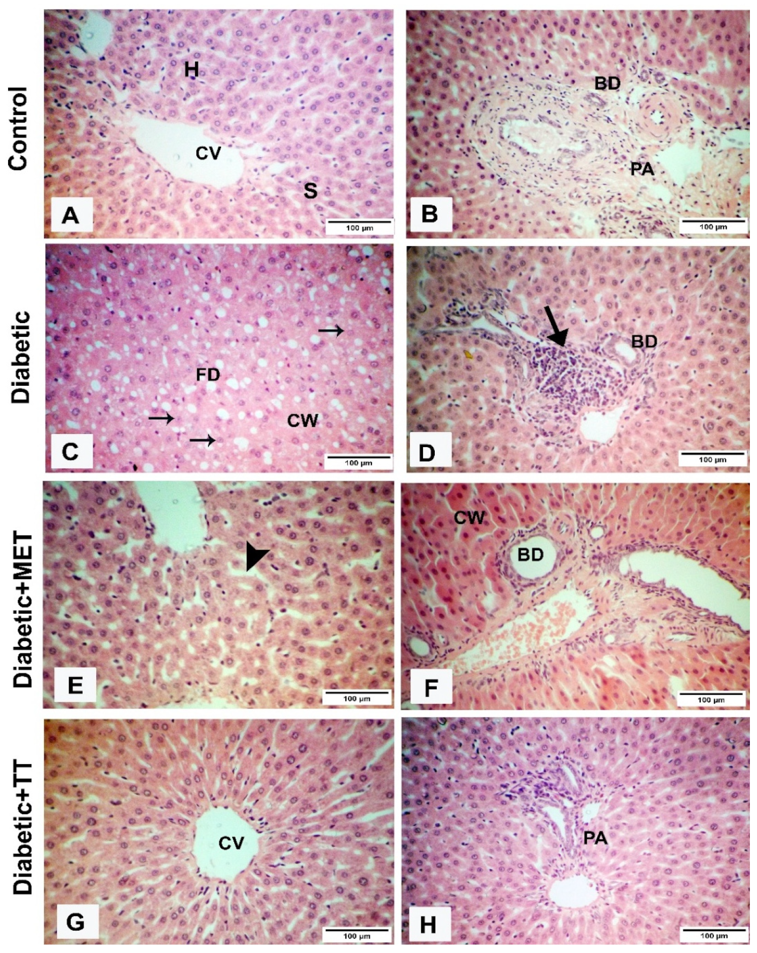 Diabetology 03 00004 g002