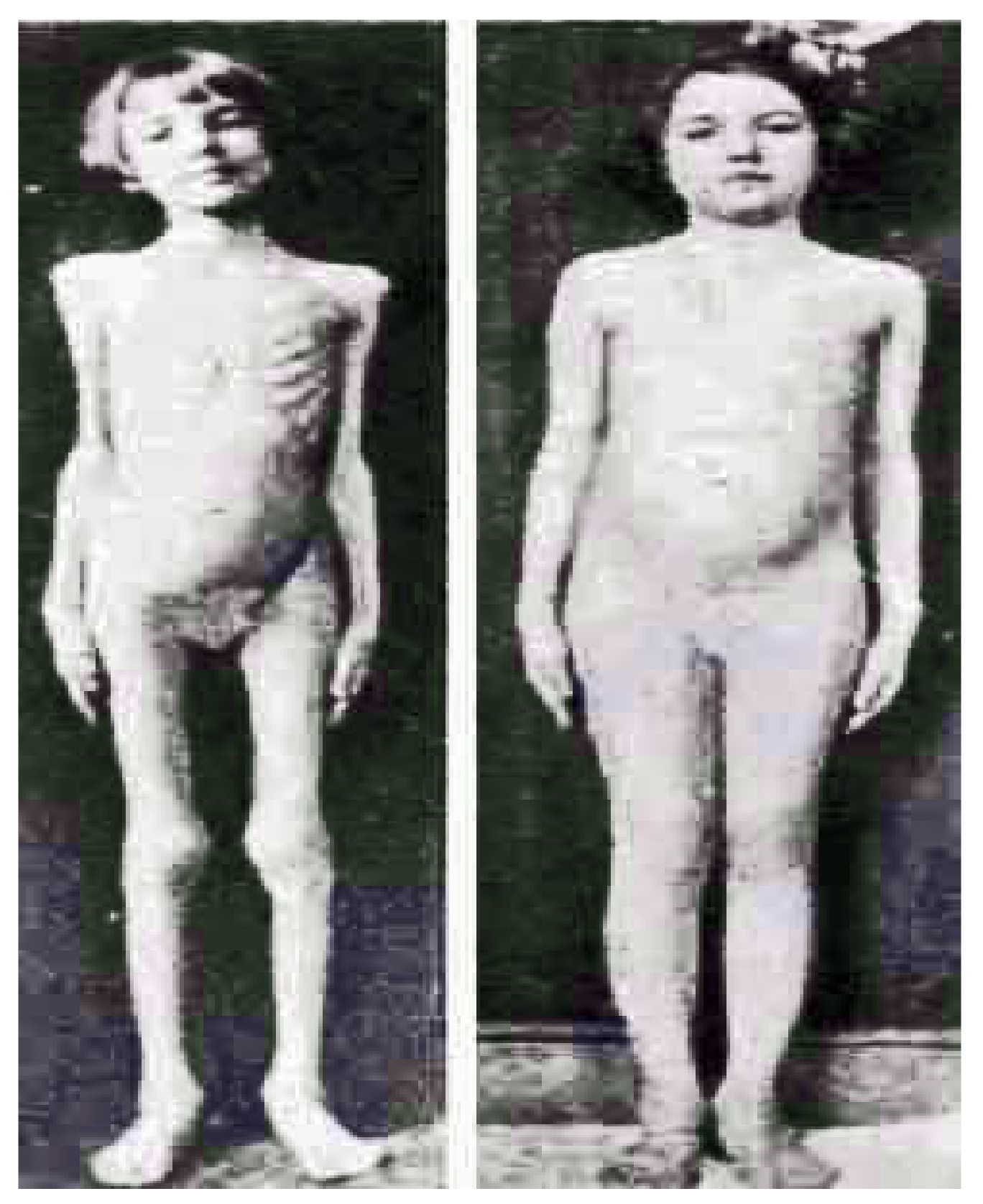 Diabetology 03 00010 g009