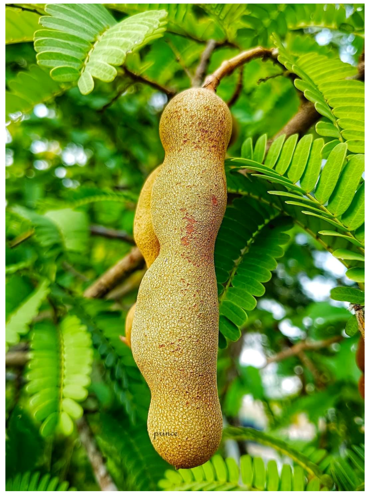 Diabetology 04 00019 g034