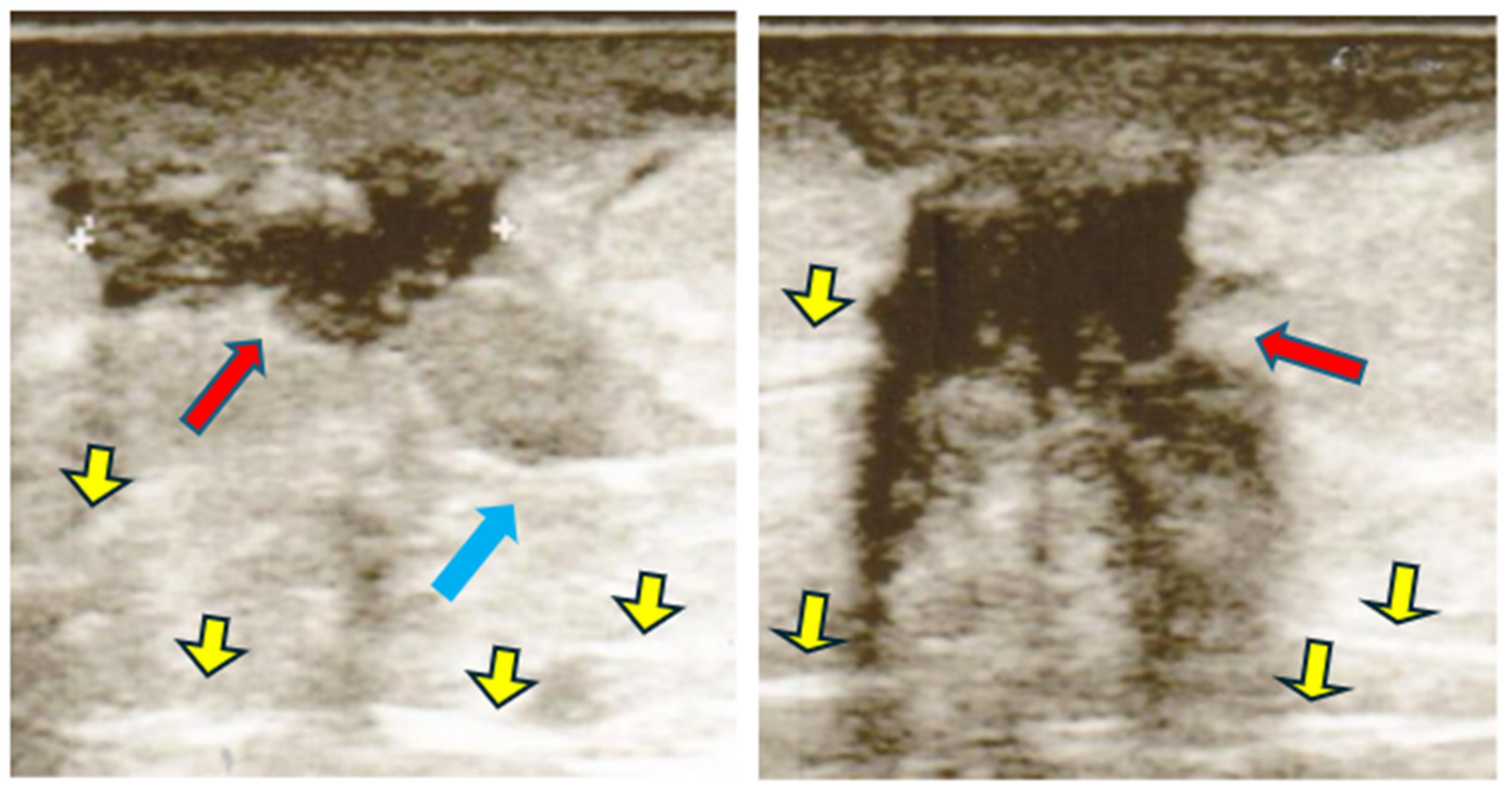 Diabetology 05 00053 g004