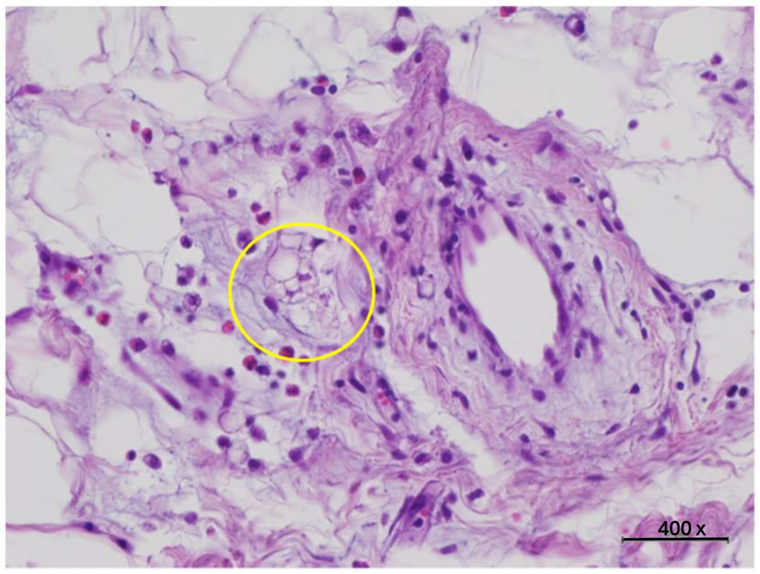 Diabetology 05 00053 g006