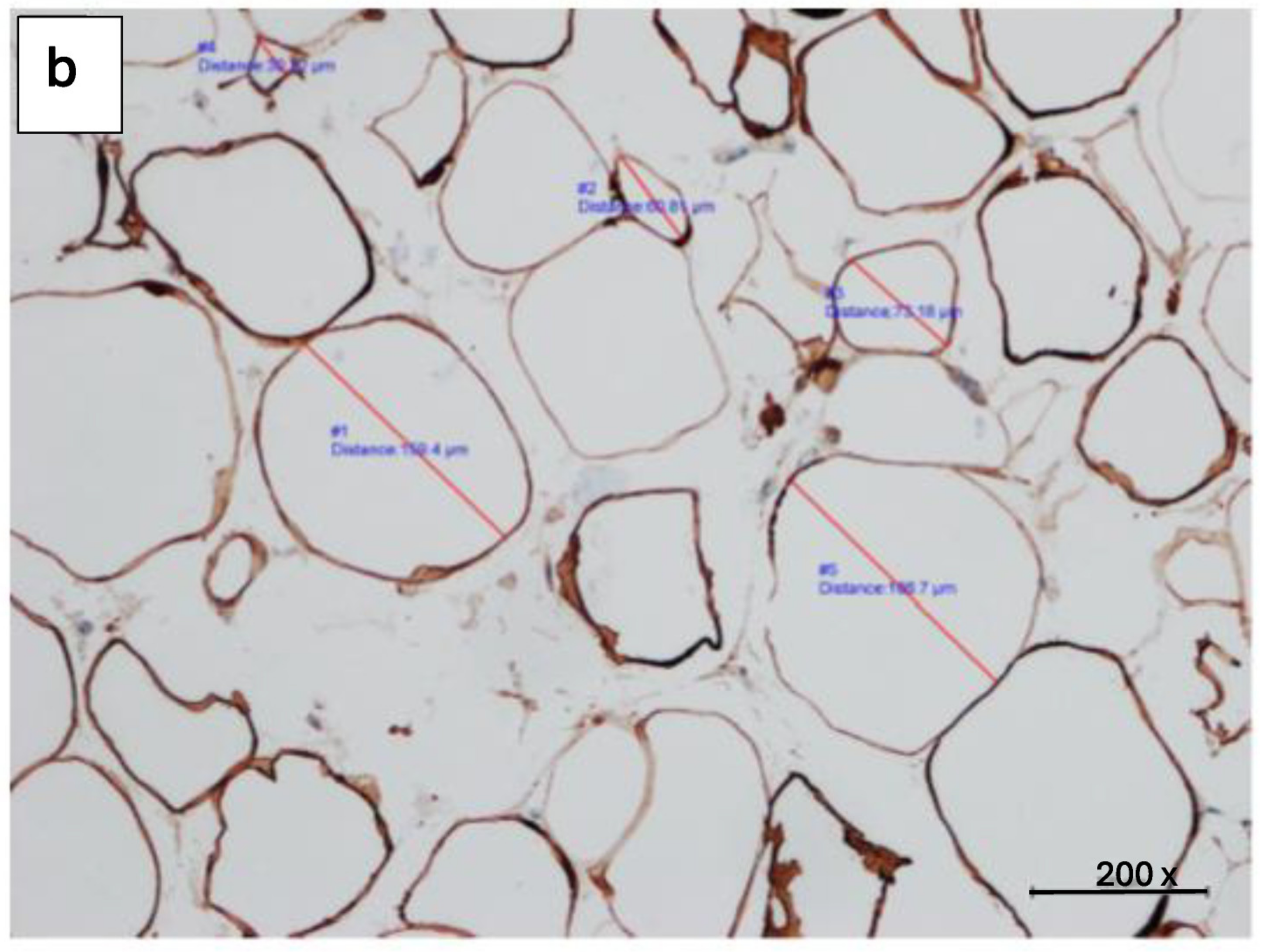 Diabetology 05 00053 g008b