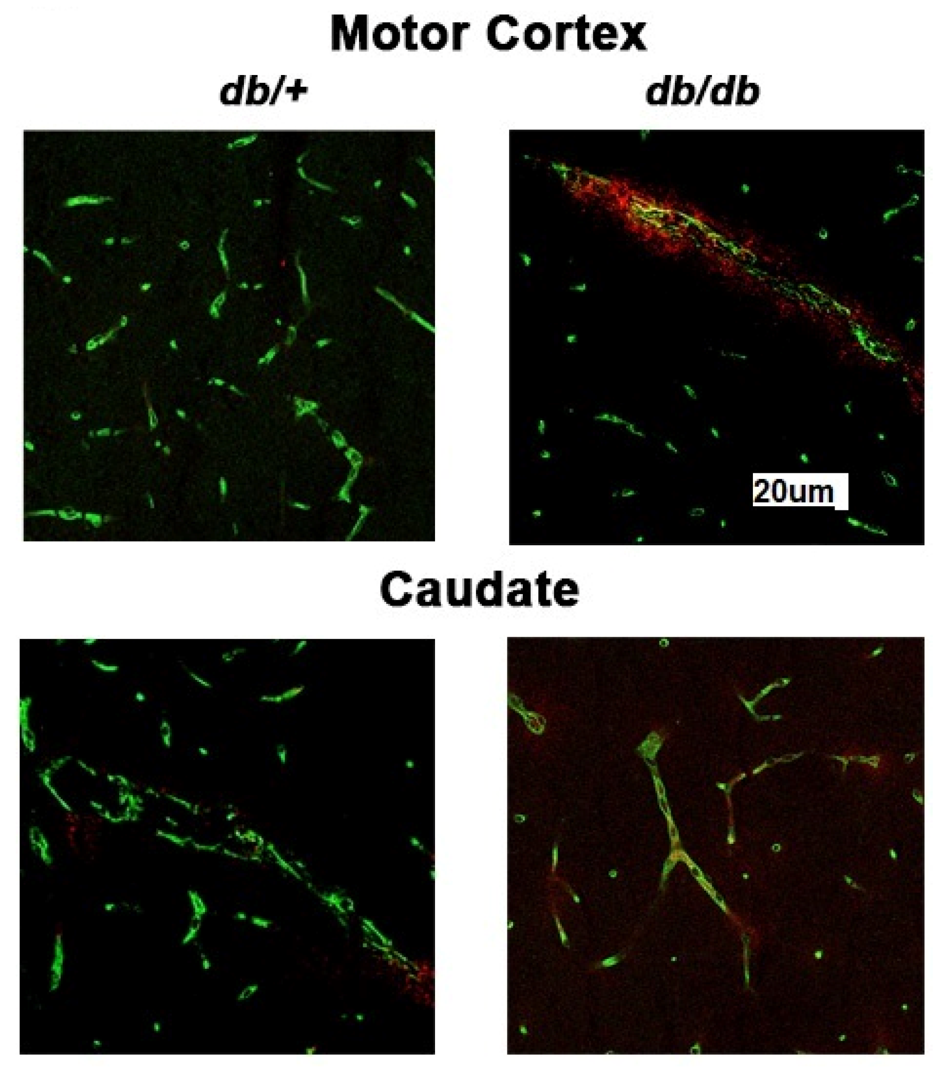 Diabetology 06 00016 g005