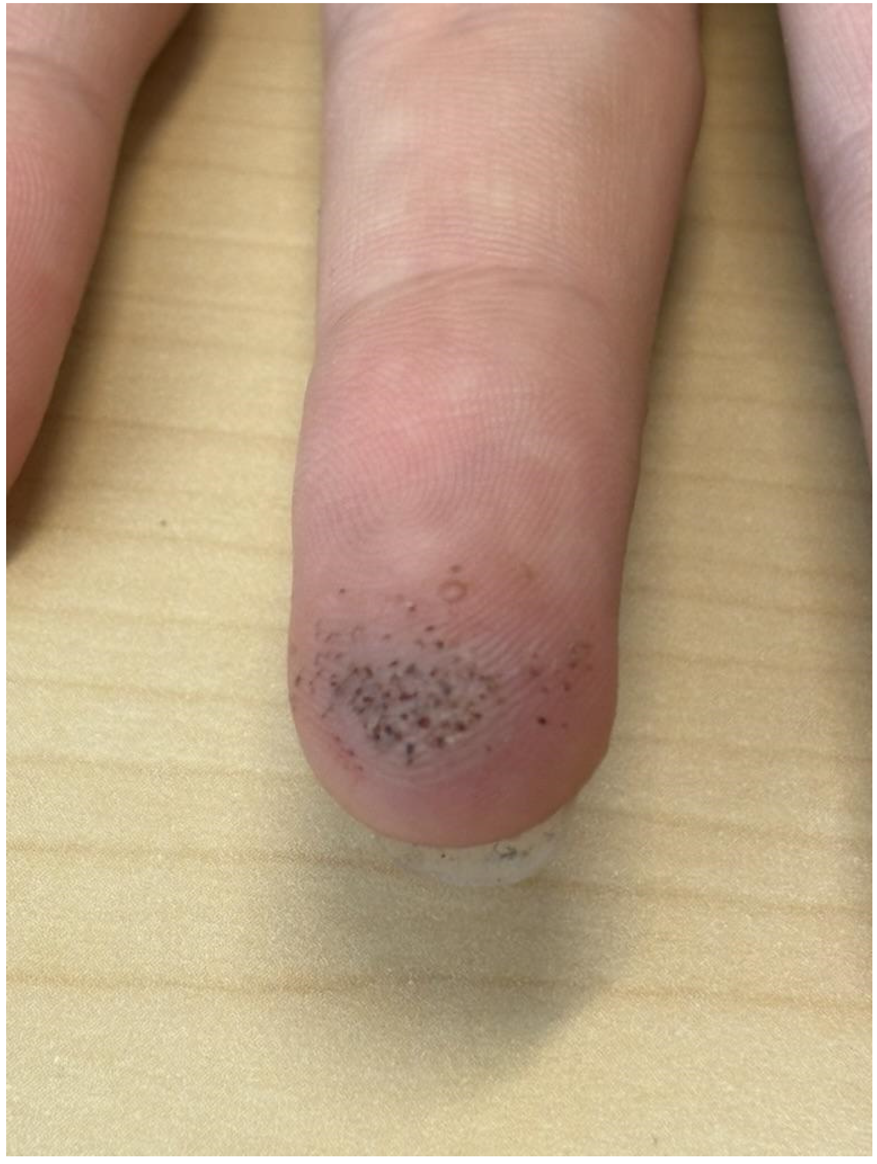 Diabetology 06 00018 g008
