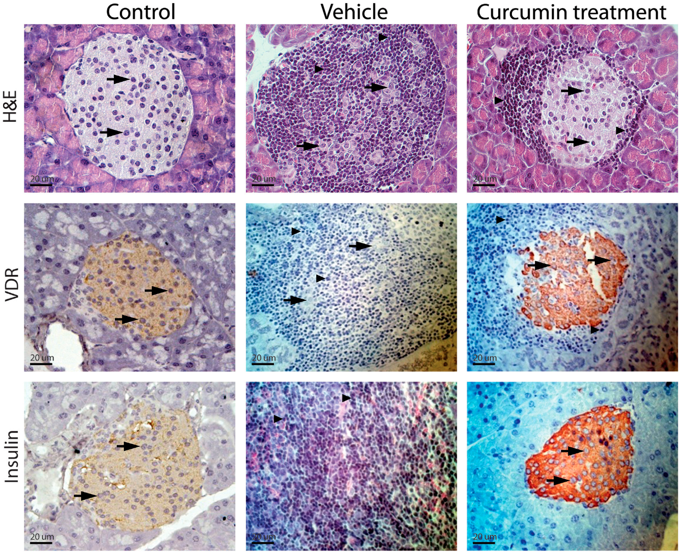 Diabetology 07 00031 g002