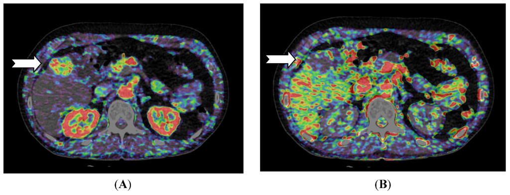 Diagnostics 03 00261 g002 1024
