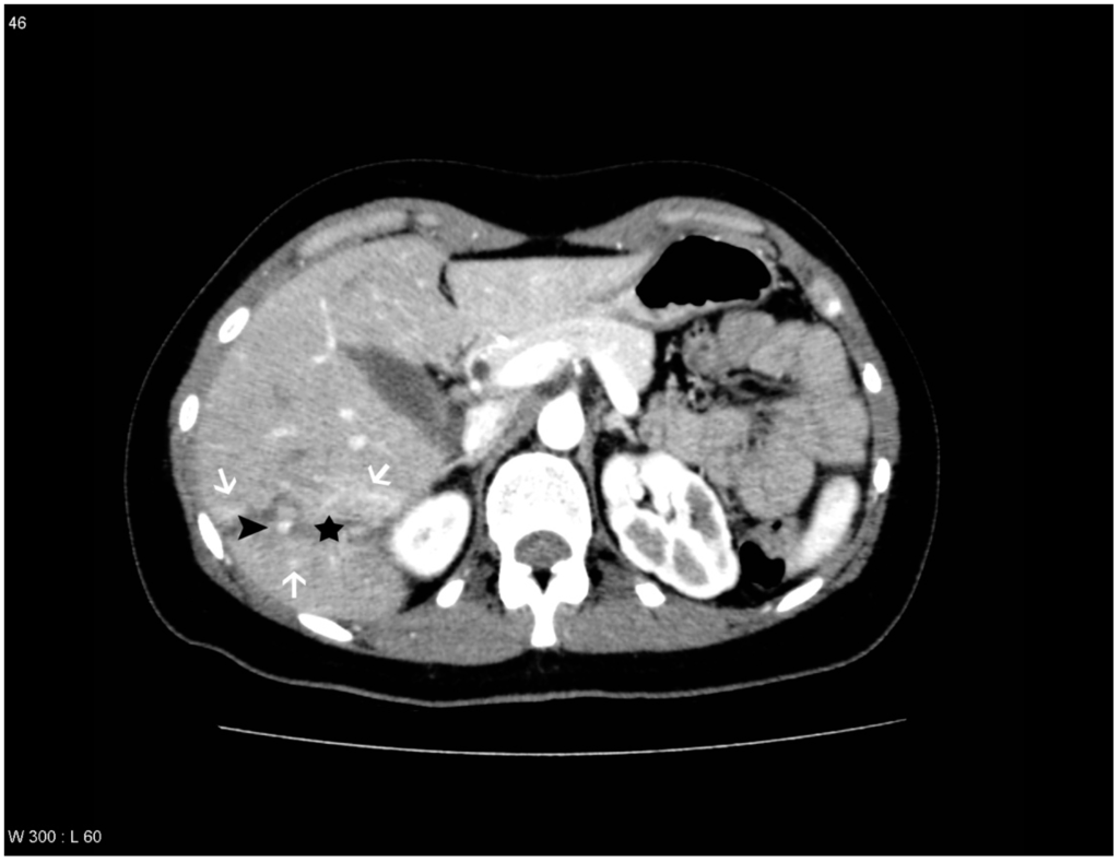 Diagnostics 04 00129 g004 1024