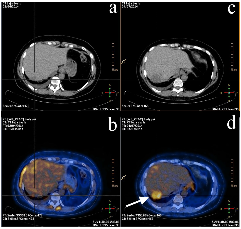 Diagnostics 05 00061 g002 1024