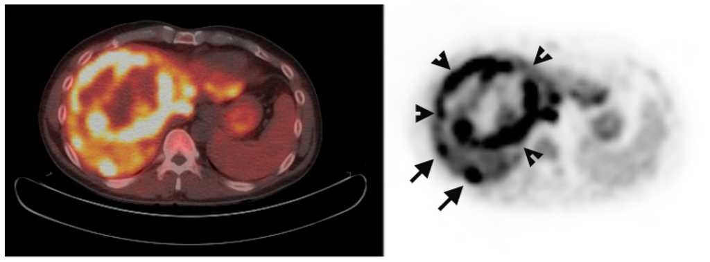 Diagnostics 05 00189 g004 1024