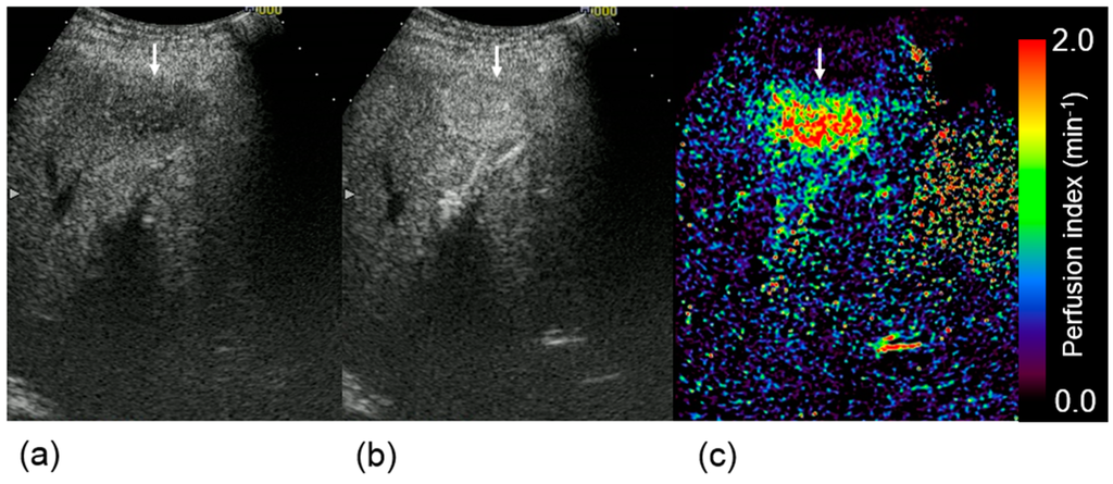 Diagnostics 05 00210 g006 1024
