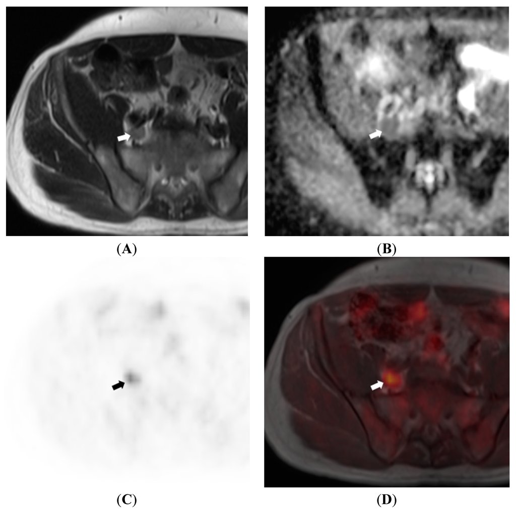 Diagnostics 05 00333 g005 1024