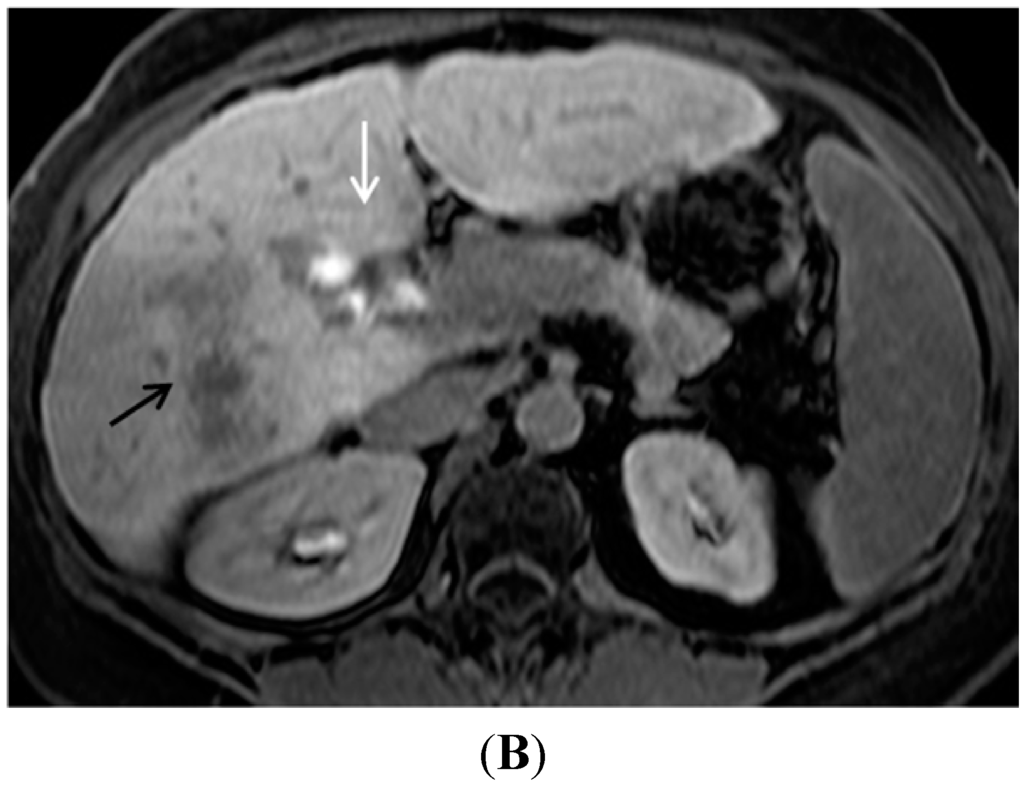 Diagnostics 05 00383 g004b 1024