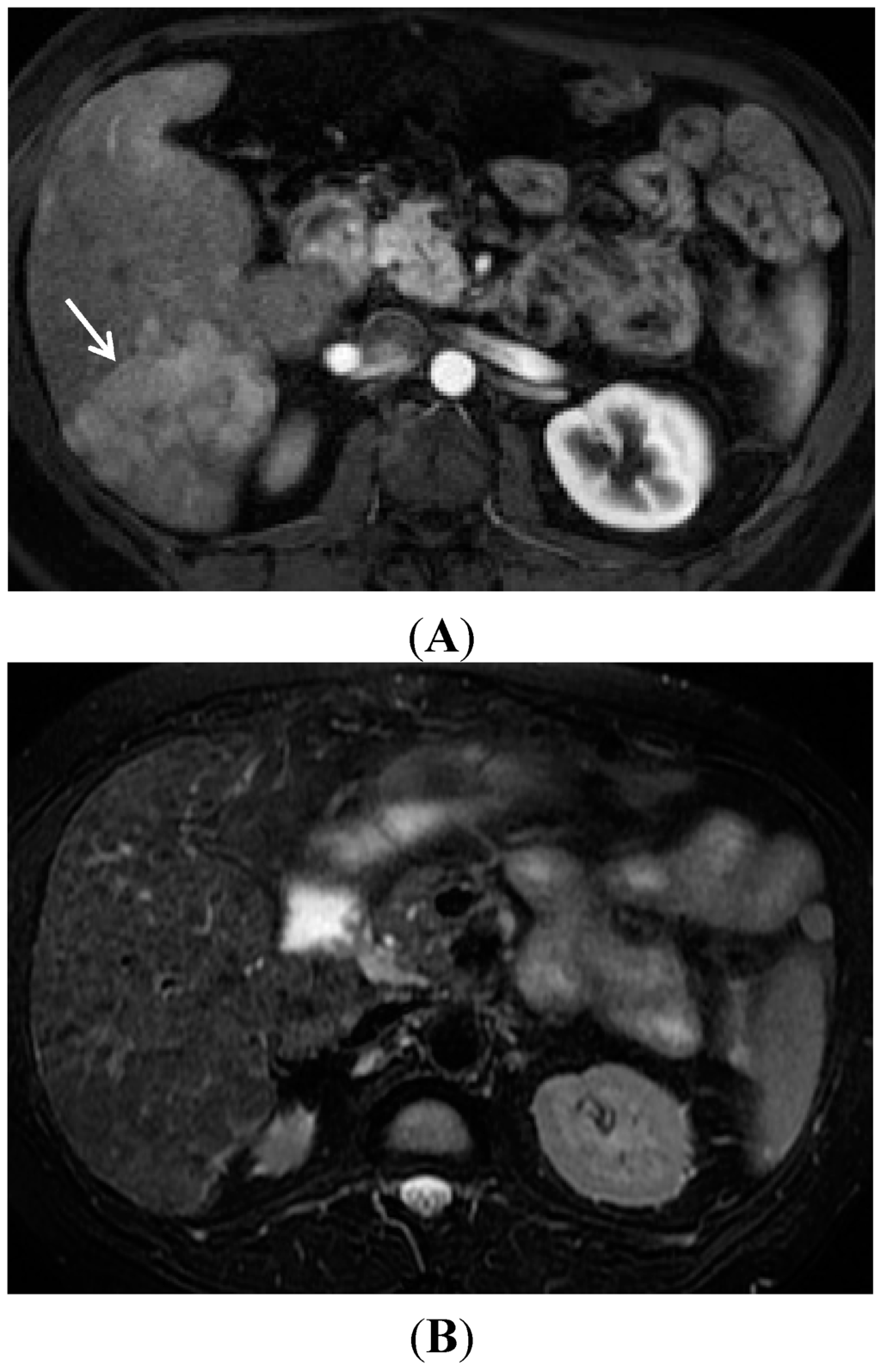 Diagnostics 05 00383 g006 1024