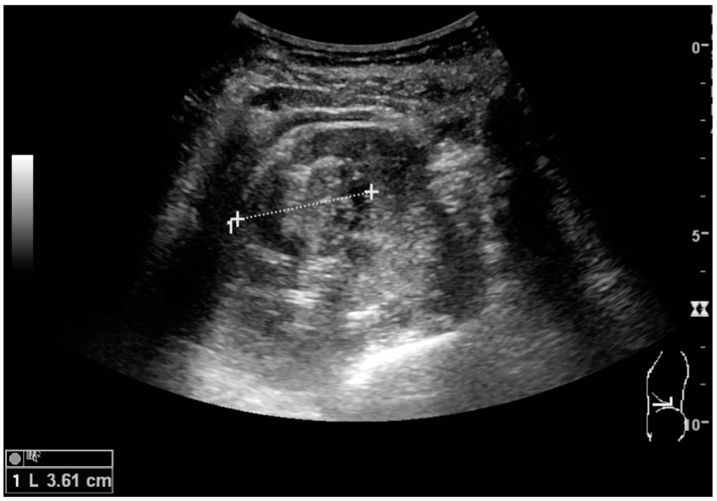 Diagnostics 06 00002 g008 1024