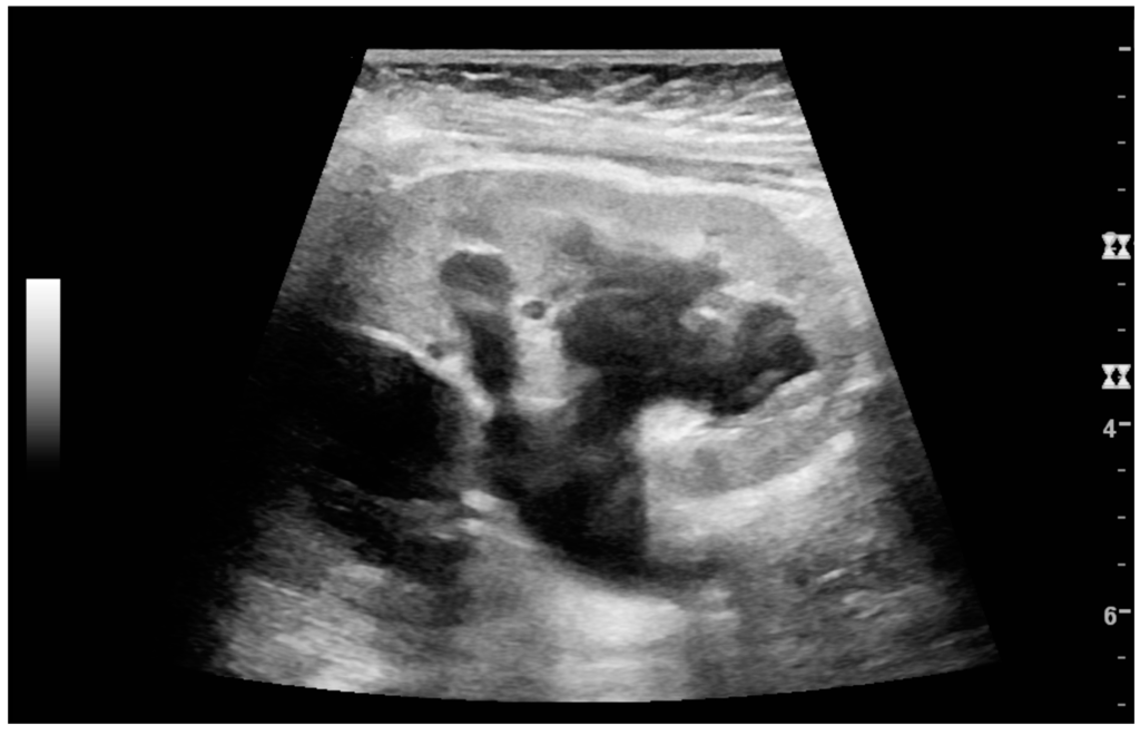 Diagnostics 06 00002 g013 1024