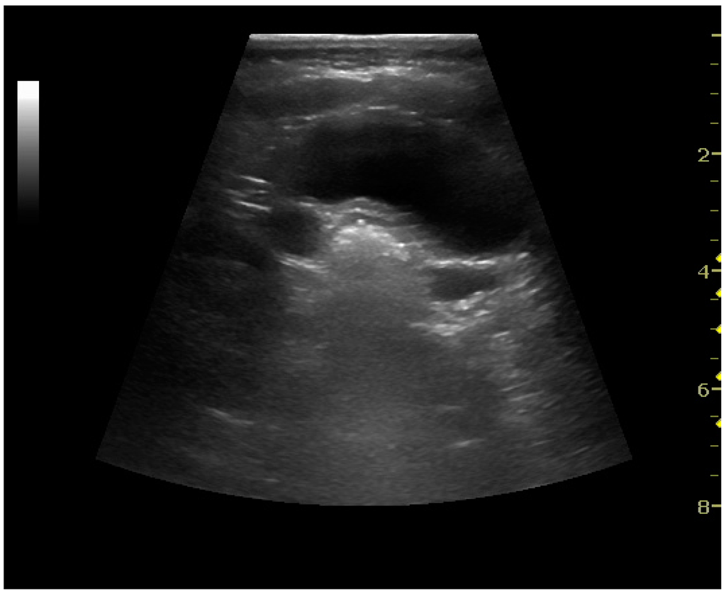 Diagnostics 06 00002 g014 1024