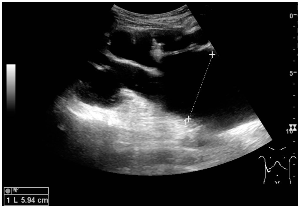 Diagnostics 06 00002 g015 1024