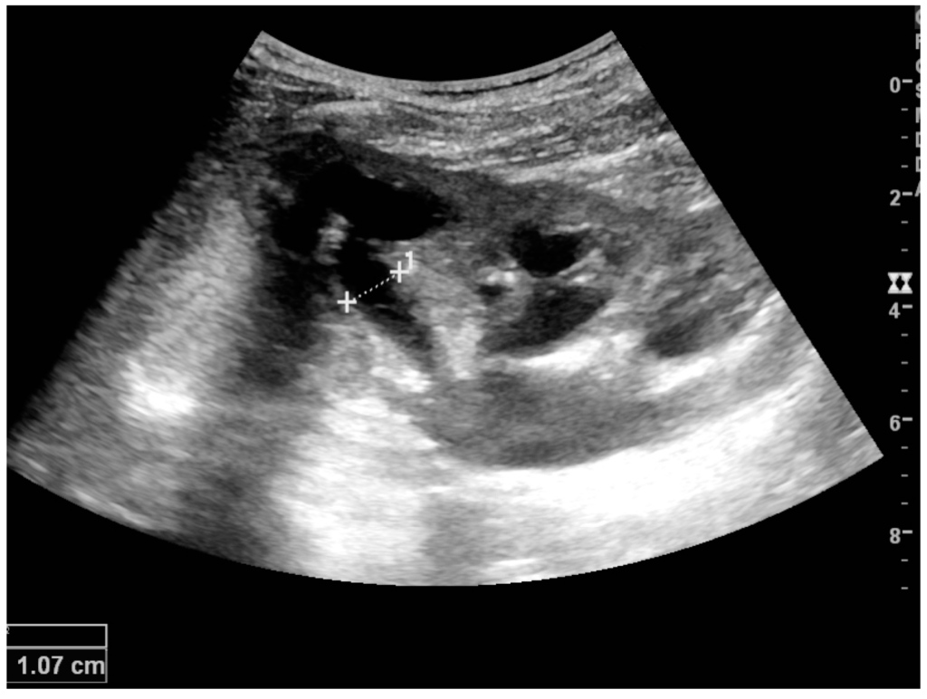 Diagnostics 06 00002 g016 1024