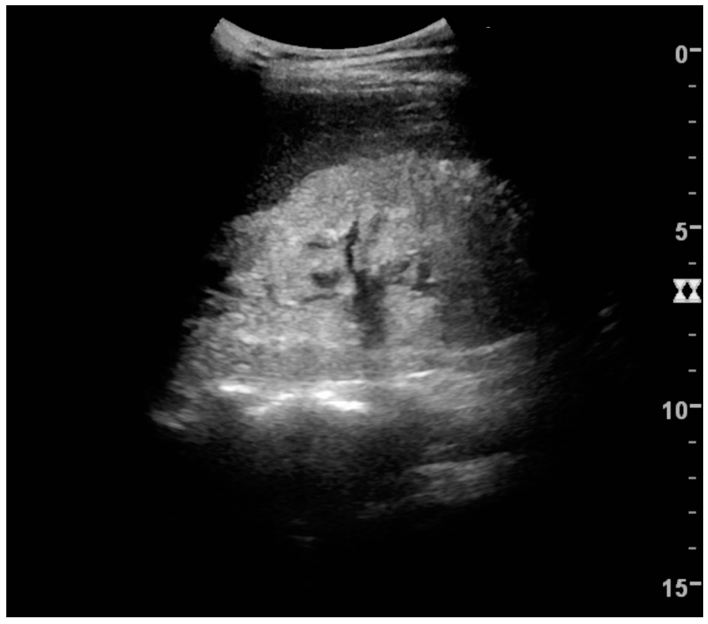 Diagnostics 06 00002 g023 1024