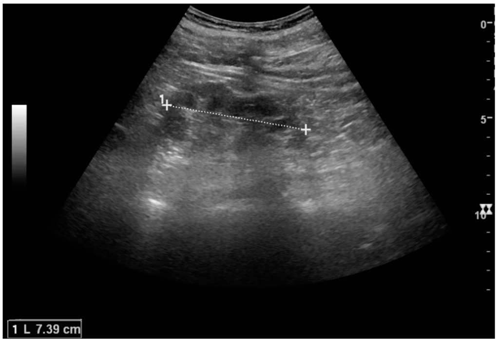 Diagnostics 06 00002 g024 1024