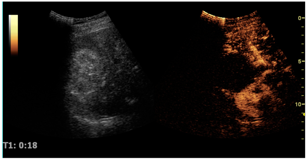 Diagnostics 06 00002 g030 1024