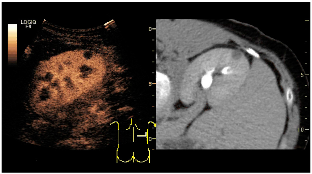 Diagnostics 06 00002 g031 1024