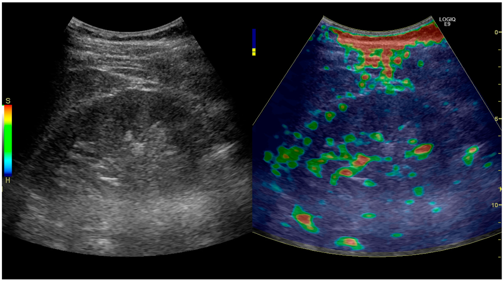 Diagnostics 06 00002 g032 1024