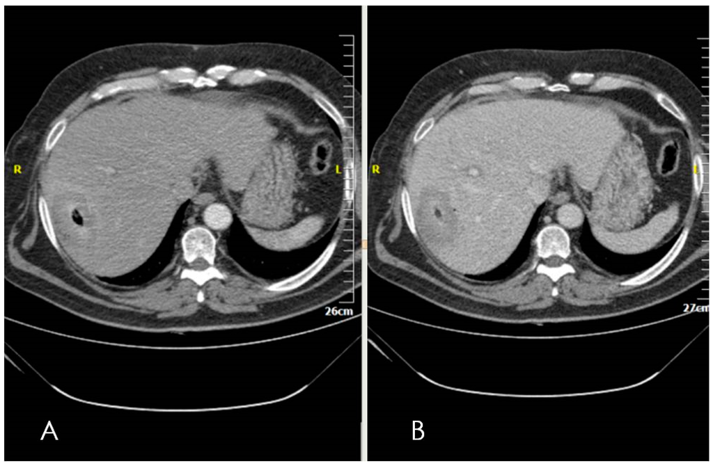 Diagnostics 06 00009 g001 1024